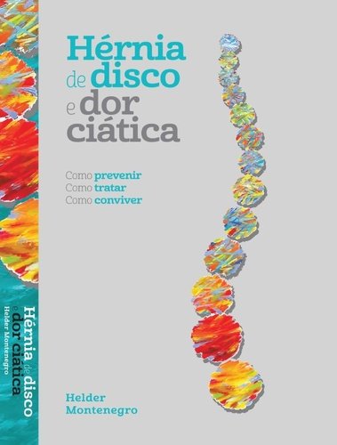 Hernia De Disco E Dor Ciatica