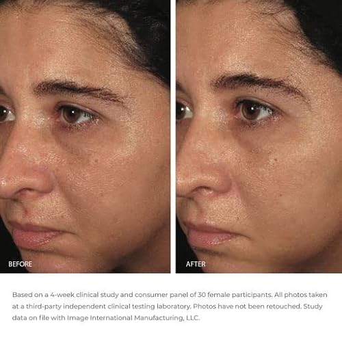 Image Skincare Ormedic Biopeptide Crème 2Oz #TOP4