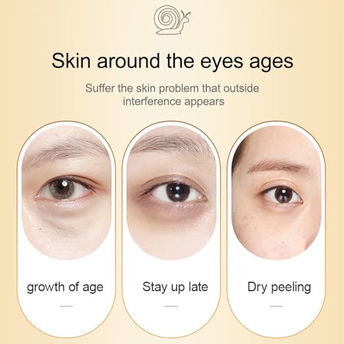 Snail Essence Eye Cream, Moisturise Nourise Eye Serum Anti Aging Snail Mucus Eye Cream For Dark Circles, Eye Skin Firming Mens & Women Eye Cream, Reduces Fine Lines Eye Bags - Image 7