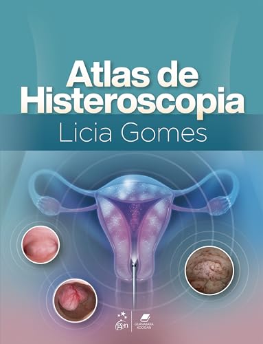 Atlas de histeroscopia: