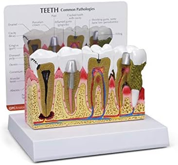 GPI Anatomicals Human Teeth Anatomy Model with Common Dental Problems