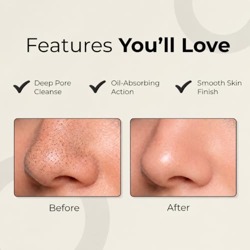 Image of Nose Strips for Blackheads | Pack of 6 | Deep Cleansing Nose Strips | Oil Control & Pore Care | For Men & Women