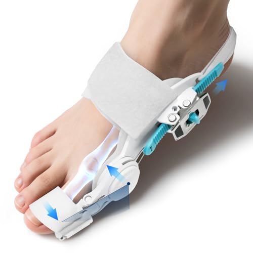 bunion splints