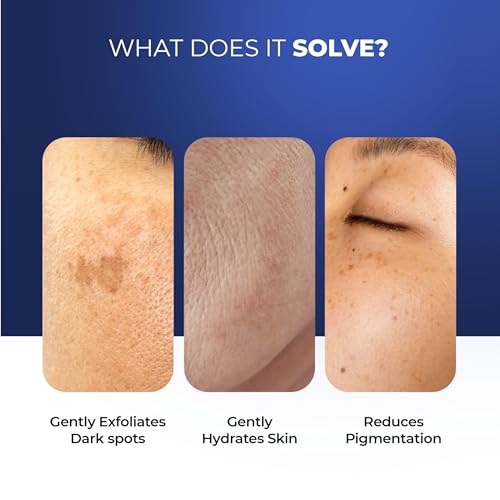 Image of Aqueria Hydrating & Brightening French Face Wash with Creamide Complex | Deep Cleansing, Non-Drying, Non-Stripping Gentle Cleanser for Dry to Normal, Sensitive Skin | Alpha Arbutin, Niacinamide, Fruit AHA BHA & Hyamagic-4D for Barrier Support & Even-Toned Skin | Reduces Pigmentation & Tanning | Dermatologist Validated, Fragrance Free, Gentle Foaming Formula | Pack of 2 (200ml)