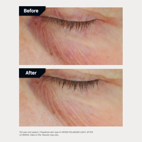 Revision Skincare C+ Brightening Eye Complex™ With Vitamin C And Antioxidants, Eye Cream For Dark Circles And Under Eye Puffiness thumb #5