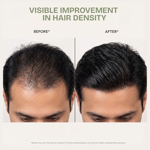 Image of Proskire Ultimate Hair Growth Oil | Lightweight Non-Greasy Hair Growth Oil with Rosemary, Batana & Bhringraj | Reduces Hair Fall & Boosts Hair Density - 100ml