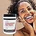 Beverly International Collagen Peptides Protein Powder. Youthful Appearance- Skin, Hair, Nails, Bones and Joint Health. Easy to Use, Highly Absorbable. 18 Grams of Protein, Unflavored 20 oz.