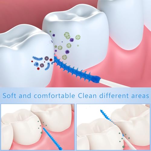 200 Stück Interdentalbürsten, Silikon Zahnzwischenraumbürsten Dentalbürsten mit Box, Tragbarer Dual-Use Zahnseide Stick für Zahnreinigung Zwischenräume (Grün, Orange) – Bild 5