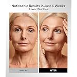 Red Light Therapy Mask for Face & Neck – 4 Light Modes with 850nm NIR, Red, Yellow & Blue LED Light Therapy, 2600mAh Rechargeable LED Face Mask for Anti-Aging, Skin Firming & Radiant Glow at Home - Image 4