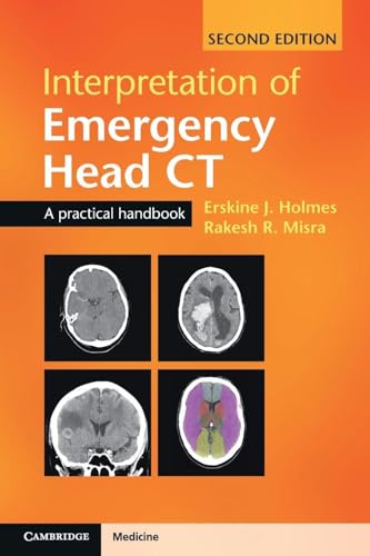 Interpretation Of Emergency Head Ct: A Practical Handbook