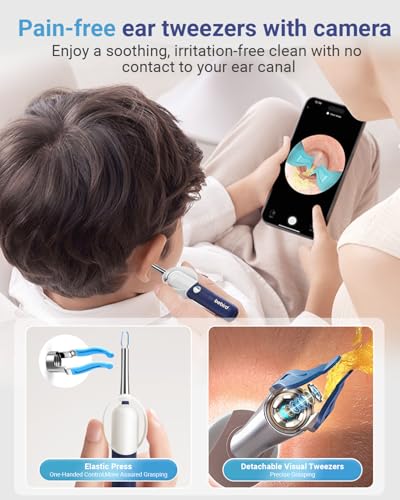 Ear Wax Removal Tool Camera, Flexible Ear Cleaner with Camera Otoscope Light, Painless Visual Ear Picker Tweezers Earwax Remover, Portable Safe Ear Cleaning Kit for Adults & Kids — view 4
