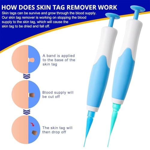 Image of Upgraded 2-in-1 Skin Tag Removal Kit - Auto Skin Tag Remover for Micro to Large Tags (2mm-8mm) - Includes Micro & Regular Removal Bands - Safe & Effective Skin Tag Remover Tool