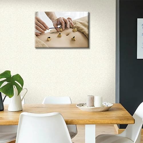 Image of Moxa Moxibustion Prints for Wall Decor Moxibustion Framed Wall Art Posters & Prints 1 Panels Nosocomium Paintings Giclee Print Gallery Packaging Artwork (12 inch Wx18 H)