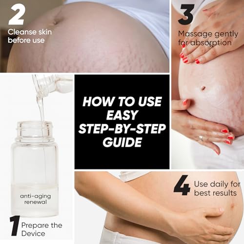 Stretch Mark System for Skin Care - Stretch Marks Removal, At-Home Beauty Tool for Postpartum Skincare | Improve the Look of Uneven Skin Texture, Firmness & Smooth, Glowing-Looking Skin