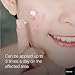 Neutrogena Rapid Clear Stubborn Acne Spot Treatment Gel with Maximum Strength 10% Benzoyl Peroxide Acne Treatment Medication, Pimple Cream for Acne Prone Skin Care, 1 oz, 2 Pack