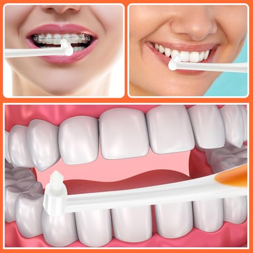 Ouligay 5 Stück Tuft Zahnbürste Einbüschelbürste Getuftet Bürste Weich Büschelzahnbürste Kleine Tuft Toothbrush Zwischenräum Zahnbürste Zahnlücke Bürste für Zahnspange
