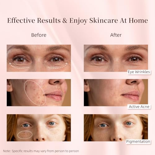Image of LED Light Therapy Machine, Red Light Therapy for Body, LED Face Mask, Light Therapy, 8 in 1 Home Color Equipment