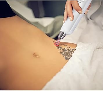 4000W high-Power White picosecond Laser Hair Removal Device, 3 wavelengths 808nm+755nm+1064nm, Freezing-Point Painless Hair Removal, Portable for Home use, Suitable for All Skin Types. (White)