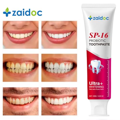 Image of 2-Pack SP-16 Teeth Whitening Toothpaste for Sensitivity Relief, Dual Fluoride Cavity Prevention & Enamel Strengthening, Anti-Stain Formula, Mint Fresh Breath, 4.23 oz*2