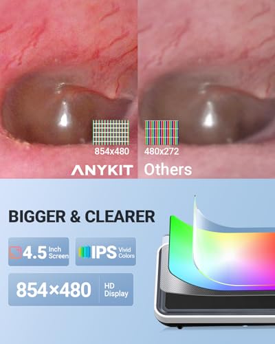 Image of Anykit Digital Otoscope with Gyroscope, 4.5 Inches Screen, 3.9mm Ear Scope Camera with 6 Lights, Ear Wax Removal Tool, 32GB Card, Supports Photo Snap and Video Recording