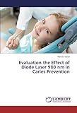 laser 980 nm  Evaluation the Effect of Diode Laser 980 nm in Caries Prevention