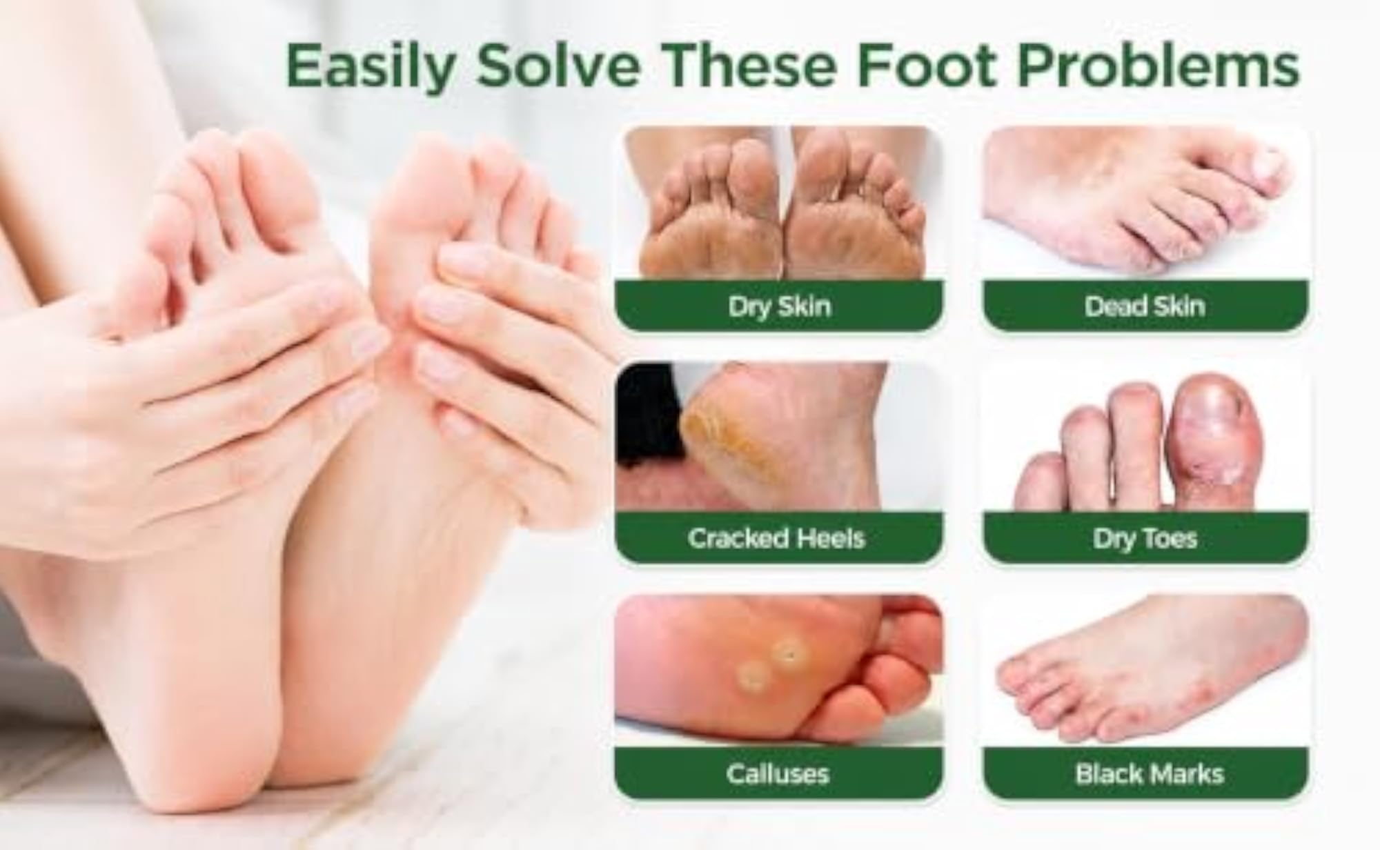 Foot Exfoliation Mask for Men and Women, Deep Cleansing Treatment