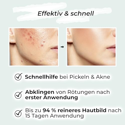 Vigorous Zinksalbe gegen Pickel 60ml – Hautpflege gegen Unreinheiten