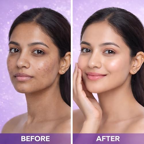 Image of Glycolic Acid 6% & Kojic Acid 2% Face Serum | Brightening & Even Skin Tone Serum | Helps Reduce Appearance of Dark Spots, Pigmentation & Dull Skin | 30 ml