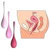 Roluck Liebeskugeln für die Frau, Silikon Anal Plug Vaginal Dilator Anal Training Kit, Kegel Balls 3er Set Liebeskugeln für die frau beckenboden Sexspielzeug für Prostata Massage Anal Dilator #3