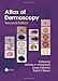 An Atlas of Dermoscopy