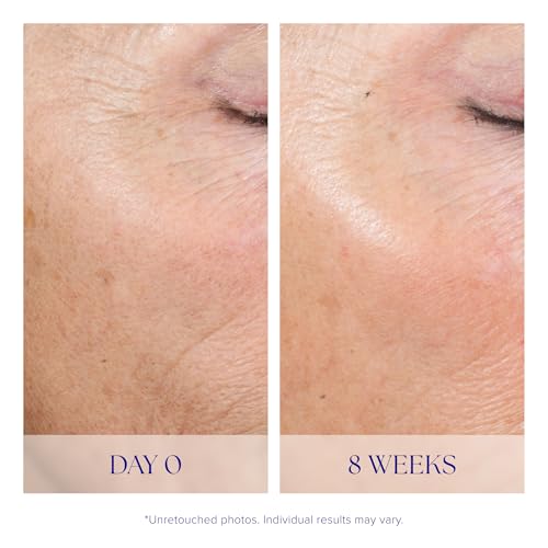 iS CLINICAL Active Peel System, two-step gentle at-home peel system for face Exfoliation - Thumbnail 5