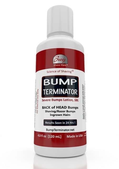 BUMP TERMINATOR Severe Bumps Treatment | Razor Bumps And Ingrown Hair Treatment | Bikini Bumps | Back of Head Bumps And Ingrown Hair Treatment, 4 oz. (Pack of 1)