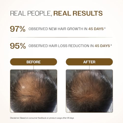 Image of Bare Anatomy Advanced Hair Growth Serum Roll-On| 3% Redensyl + 4% Anagain + 2% Baicapil + 5% Rosemary, Rice Water, Biotin & Saw Palmetto| Reduces Hair Fall, Supports Hair Growth for Men & Women | 25ml