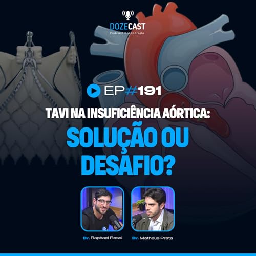 191 - TAVI na Insuficiência Aórtica: solução ou desafio? Podcast Por capa