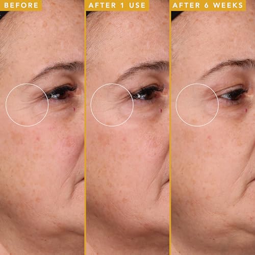 Farmacy Filling Good and Retinol Bundle - Hyaluronic Acid Serum for Face & 1% Vitamin A Resurfacing Retinol Serum