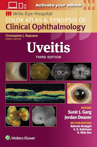 Uveitis (Wills Eye Institute Atlas Series)