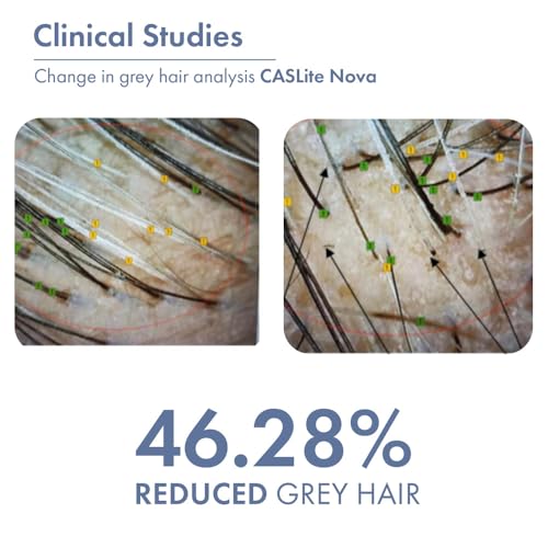 ThriveCo Anti-Grey Hair Prime Serum | Reverses & Limits Hair Greying | Arcolys + Biotin + Black Tea Extract | Light-Weight, Non-Sticky & Odourless | For Men and Women | 30 Ml (Pack of 1)