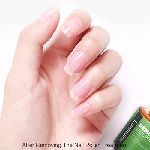 Removedor de esmalte em gel | Removedor de esmalte em gel | Removedor de esmalte de gel fácil remove