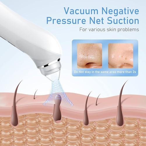 Image of HD Camera USB Blackhead Remover, 3 Modes 6 Heads for Men Women | 20x magnified cleaning, APP WiFi connection, adjustable vacuum suction, effective blackhead removal, one-month long standby