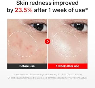 CENTELLIAN 24 Madeca Cream Time Reverse (50ml/1.69fl oz, Pack of 2) Advanced Fast-Absorbing & Nourishing Cream, Hydrates, Reduces Wrinkles, Korean Skin Care, Centella Asiatica