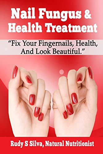 Nail Fungus & Health Treatment: Fix Your Fingernail?s Health And Look Beautiful