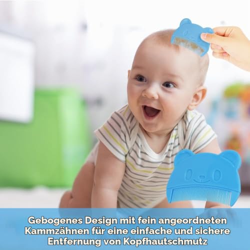 Aolso Baby kamm für milchschorf, 2 Stück Babykamm, Baby-Haarkamm, Baby Haarbürste mit weichen Zähnchen, Neugeborene Haarkamm… – Ansicht 4