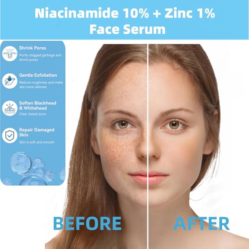 Niacinamide 10% + Zinc 1% Serum for Face – Oil Control, Acne, Pore Minimizer & Blemish Reduction – Lightweight, Non-Greasy Facial Serum, 30ml (1 Fl Oz) (1) - Image 3