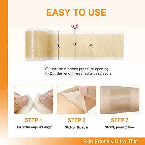 Carbou Silicone Scar Sheets (1.6"X 60"Roll) Medical Silicone Scar Tape Roll,Easy-Tear Soft Silicone Tape For Scars Removal,Reusable Painless Silicone Sheets For Surgery Scars, C-Section, Burn, Keloid #TOP5