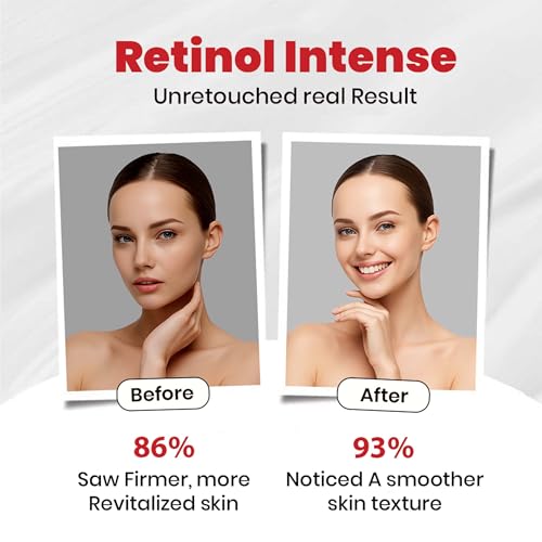 Image of Retinol 0.1 Intense Cream with Collagen & Peptide Vitamin A for Fine Lines, Sun Spots, Anti-Aging (40 Gram / 1.41 Oz)