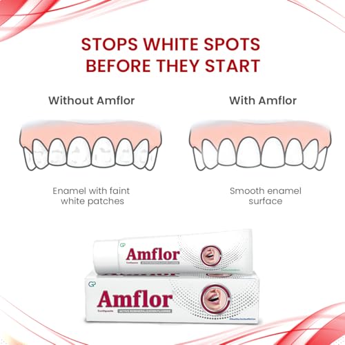 Amflor Toothpaste for Braces | Prevents Cavities & White Spot Lesions | Organic Amine Fluoride for Enamel Remineralization| Mint Flavour Orthodontic Toothpaste | Pack of 6 (70 g per pack)
