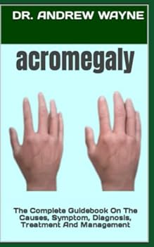 Paperback acromegaly: The Complete Guidebook On The Causes, Symptom, Diagnosis, Treatment And Management Book