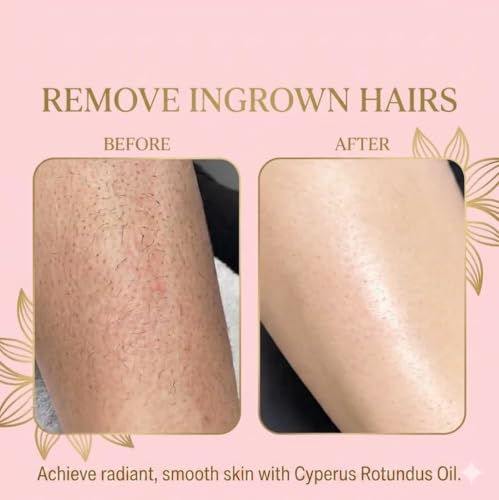 Image of Cyperus Rotundus Oil 60ml | Natural Hair Removal Oil | Helps Reduce Body Hair Growth & Softens Regrowth | Moisturizing & Soothing Formula for Smooth Skin | For All Skin Types