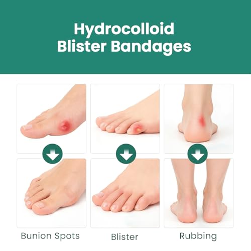 Image of Welnove Gel Blister Bandage - 24 PCS Hydrocolloid Bandages for Prevention & Recovery, Blister Cushions for Heel, Toes & Foot, Blister Bandages for High Heels, Sandals, Wedding, Party (Toe Pack)