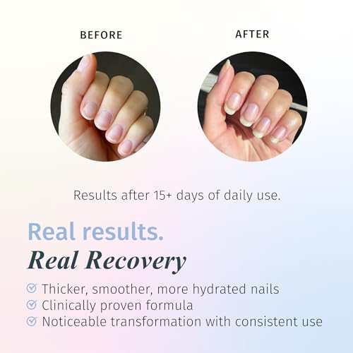 Duri Rejuvacote 1 Original Maximum Strength Nail Growth System Base and Top Coat - Nail Hardener Repair Chipping Strengthen Breaking and Brittle Treatment, by Duri Cosmetics (Pack of 1) - Image 3